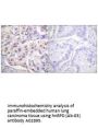 Anti-hnRPD (Ab-83) HNRNPD Antibody