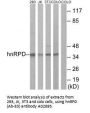 Anti-hnRPD (Ab-83) HNRNPD Antibody