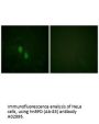 Anti-hnRPD (Ab-83) HNRNPD Antibody