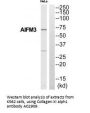 Anti-Collagen XI alpha COL11A1 Antibody