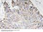 Anti-Caspase-4 CASP4 Antibody