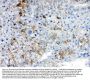 Anti-AKR1B10 Antibody PicobandÂ®