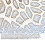 Anti-ABCB5 Antibody PicobandÂ®