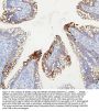 Anti-ABCB5 Antibody PicobandÂ®