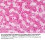 Anti-ABCB5 Antibody