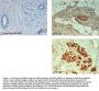 Anti-ABCB5 Antibody