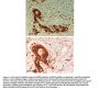 Anti-ABCB5 Antibody