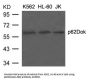 Anti-p62Dok(Ab-398) DOK1 Antibody