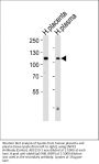 Anti-ENPP2 Antibody (Center)