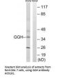 Anti-GGH/Gamma Glutamyl Hydrolase Antibody
