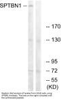 Anti-SPTBN1 Antibody