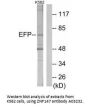 Anti-ZNF147 TRIM25 Antibody