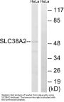 Anti-SLC38A2 Antibody