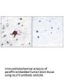 Anti-GLUT3 SLC2A3 Antibody