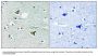 Anti-Girdin CCDC88A Antibody