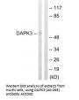 Anti-DAPK3 (Ab-265) Antibody