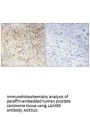 Anti-LAMB3/Laminin Beta 3 Antibody