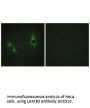 Anti-LAMB3/Laminin Beta 3 Antibody