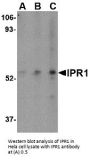 Anti-IPR1 SP110 Antibody