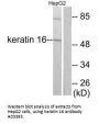 Anti-Keratin 16 KRT16 Antibody