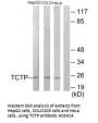 Anti-TCTP TPT1 Antibody