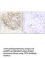 Anti-TCTP TPT1 Antibody