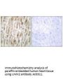 Anti-LIM domain kinase 2 LIMK2 Antibody