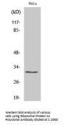 Anti-Ribosomal Protein S2 RPS2 Antibody