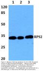 Anti-40S ribosomal protein S2 RPS2 Antibody