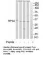 Anti-40S ribosomal protein S2 RPS2 Antibody