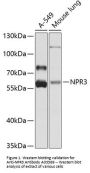 Anti-NPR3 Antibody