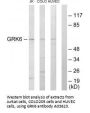 Anti-GRK6 Antibody