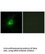 Anti-GRK6 Antibody