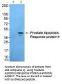 Anti-Prostate Apoptosis Response Protein-4 PAWR Antibody
