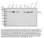 Anti-Plasminogen/PLG Antibody Picoband®
