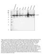 Anti-Annexin VI/ANXA6 Antibody Picoband®