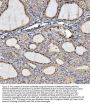Anti-Annexin VI/ANXA6 Antibody Picoband®