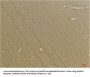 Anti-GABA B Receptor 2 GABBR2 Antibody