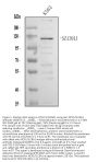 Anti-NCX1/SLC8A1 Antibody Picoband®