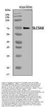 Anti-SLC5A8 Antibody Picoband®