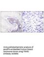 Anti-TRXR2 TXNRD2 Antibody
