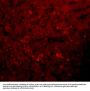 Anti-JMJD1A KDM3A Antibody
