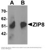 Anti-ZIP8 SLC39A8 Antibody