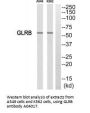 Anti-Glycine receptor subunit beta GLRB Antibody