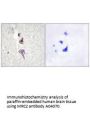 Anti-MRC2/Endo180 Antibody