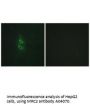 Anti-MRC2/Endo180 Antibody