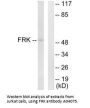 Anti-Tyrosine-protein kinase FRK FRK Antibody