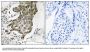 Anti-RABEP1/Rabaptin 5 Antibody