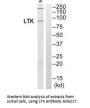 Anti-LTK Antibody