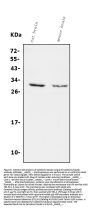 Anti-Calretinin/CALB2 Antibody Picoband®